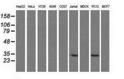 Western Blot: FHL1 Antibody (OTI3G7)Azide and BSA Free [NBP2-70739]