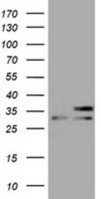 Western Blot: FHL1 Antibody (OTI3G7)Azide and BSA Free [NBP2-70739]