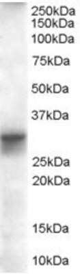 Western Blot: FHL1 Antibody [NB100-1461]