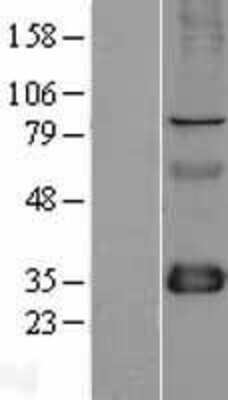 Western Blot: FHL1 Overexpression Lysate [NBL1-10714]