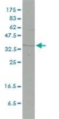 Western Blot: FHL2 Antibody (2G3-1A5) [H00002274-M01]