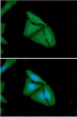 Immunocytochemistry/ Immunofluorescence: FHL2 Antibody (AT21D11) - BSA Free [NBP2-61162]