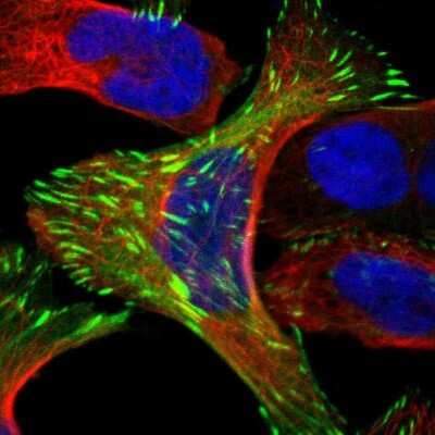 Immunocytochemistry/ Immunofluorescence: FHL2 Antibody [NBP1-84978]