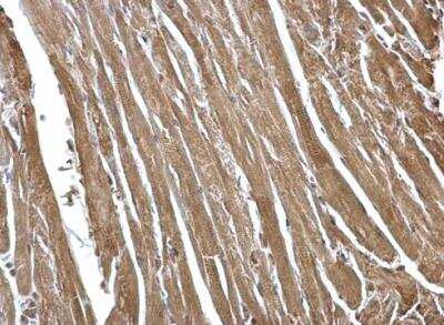 Immunohistochemistry-Paraffin: FHL2 Antibody [NBP1-33602]