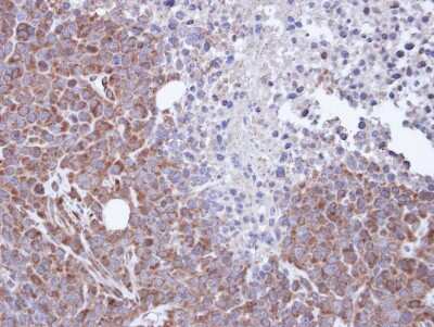 Immunohistochemistry-Paraffin: FHL2 Antibody [NBP1-33603]