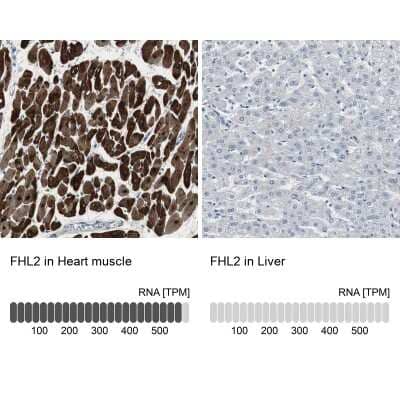 Immunohistochemistry-Paraffin: FHL2 Antibody [NBP1-84978]