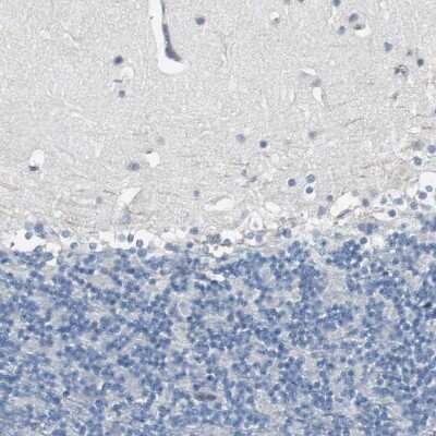 Immunohistochemistry-Paraffin: FHL2 Antibody [NBP1-84978]