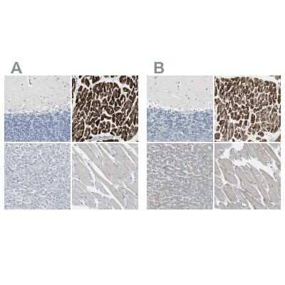 Immunohistochemistry-Paraffin: FHL2 Antibody [NBP1-84978]