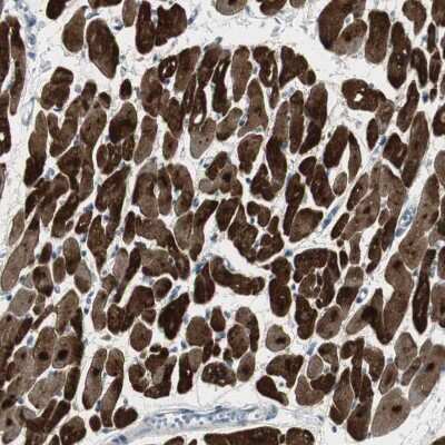 Immunohistochemistry-Paraffin: FHL2 Antibody [NBP1-84978]