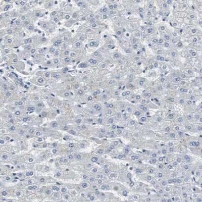 Immunohistochemistry-Paraffin: FHL2 Antibody [NBP1-84978]
