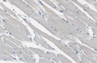 Immunohistochemistry-Paraffin: FHL2 Antibody [NBP1-84978]