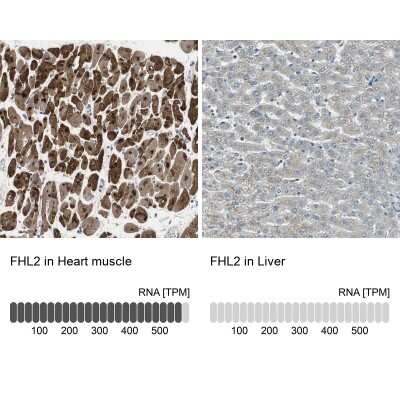 Immunohistochemistry-Paraffin: FHL2 Antibody [NBP1-84979]