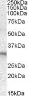 Western Blot: FHL2 Antibody [NB300-804]