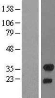 Western Blot: FHL2 Overexpression Lysate [NBL1-10715]