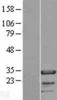 Western Blot: FHL2 Overexpression Lysate [NBP2-08208]