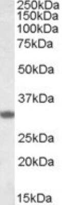 Western Blot: FHL3 Antibody [NBP1-26395]