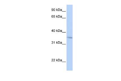 Western Blot: FHL3 Antibody [NBP2-87440]