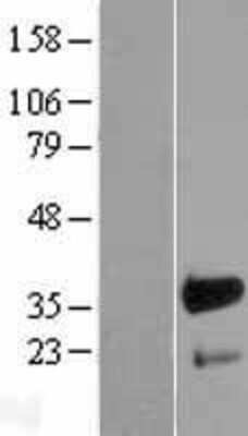 Western Blot: FHL3 Overexpression Lysate [NBL1-10716]