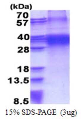 SDS-PAGE: Recombinant Human FHL3 His Protein [NBP2-23057]