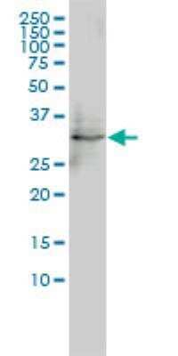 Western Blot: FHL5 Antibody (1G12-D2) [H00009457-M01]