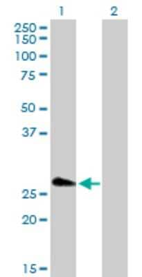 Western Blot: FHL5 Antibody [H00009457-D01P]