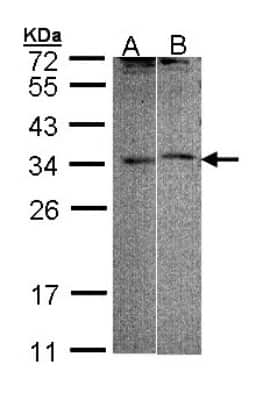 Western Blot: FHL5 Antibody [NBP1-32660]