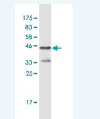 Western Blot: FHOD1 Antibody (3F7) [H00029109-M02]