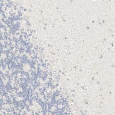 Immunohistochemistry-Paraffin: FHOD1 Antibody [NBP1-83900]