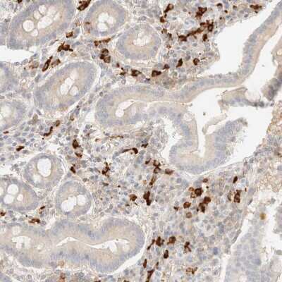 Immunohistochemistry-Paraffin: FHOD1 Antibody [NBP1-83900]