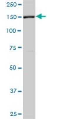 Western Blot: FHOD1 Antibody [H00029109-B01P]