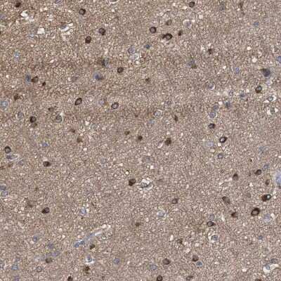 Immunohistochemistry-Paraffin: FHOD3 Antibody [NBP1-83898]