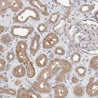 Immunohistochemistry-Paraffin: FHOD3 Antibody [NBP1-83899]