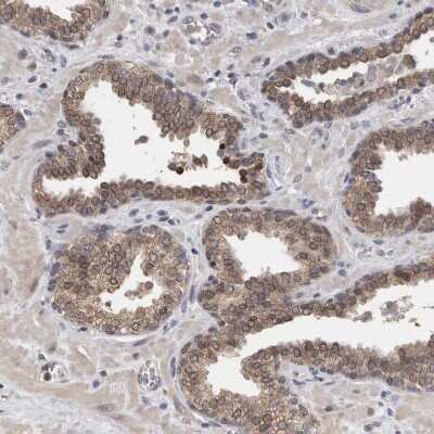 Immunohistochemistry-Paraffin: FHOD3 Antibody [NBP1-83899]