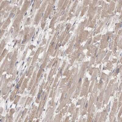 Immunohistochemistry-Paraffin: FHOD3 Antibody [NBP1-83899]