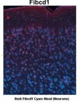 Immunohistochemistry: FIBCD1 Antibody [NBP1-91362]