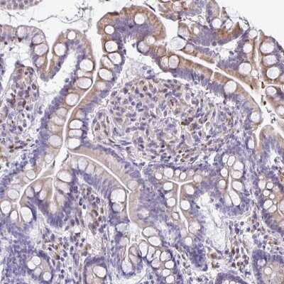 Immunohistochemistry-Paraffin: FIBCD1 Antibody [NBP2-31601]