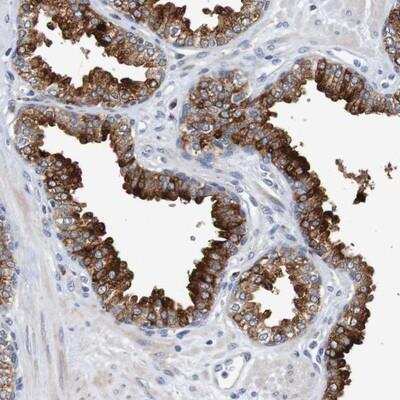 Immunohistochemistry-Paraffin: FIBP Antibody [NBP1-83903]