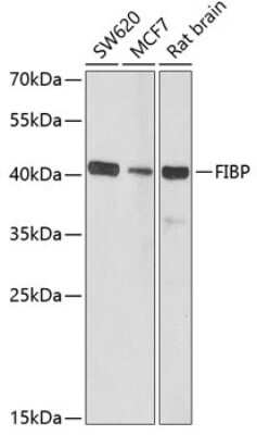 Western Blot: FIBP AntibodyBSA Free [NBP3-04701]