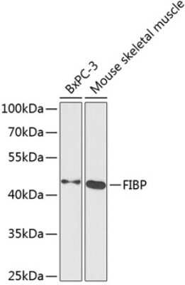 Western Blot: FIBP AntibodyBSA Free [NBP3-04702]