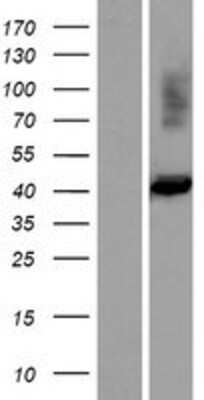 Western Blot: FIBP Overexpression Lysate [NBP2-04674]