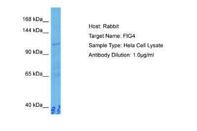 Western Blot: FIG4 Antibody [NBP2-84935]