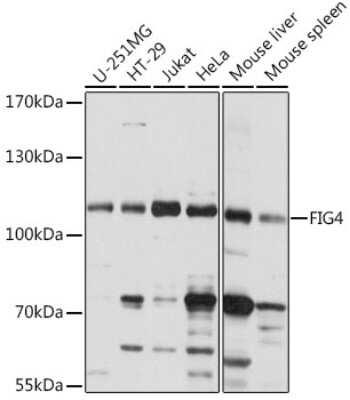 Western Blot: FIG4 AntibodyAzide and BSA Free [NBP3-05130]