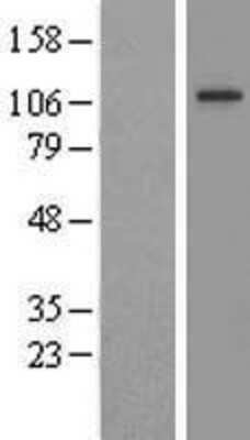 Western Blot: FIG4 Overexpression Lysate [NBL1-10721]