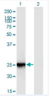 Western Blot: FIGLA Antibody (6A10) [H00344018-M03-100ug]