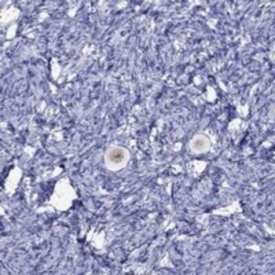 Immunohistochemistry-Paraffin: FIGLA Antibody [NBP3-17250]