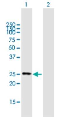 Western Blot: FIGLA Antibody [H00344018-B01P]