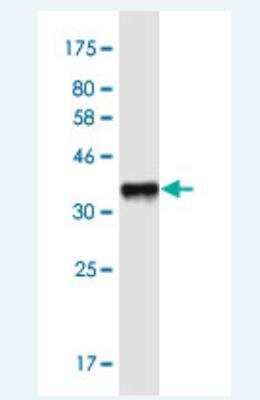 Western Blot: FIGN Antibody (2F8) [H00055137-M02-100ug]