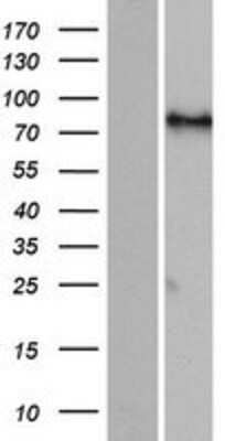 Western Blot: FIGN Overexpression Lysate [NBP2-06876]