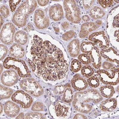 Immunohistochemistry-Paraffin: FIGNL1 Antibody [NBP2-47456]