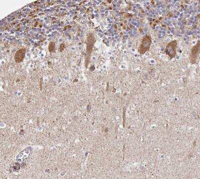 Immunohistochemistry-Paraffin: FIGNL1 Antibody [NBP2-47456]